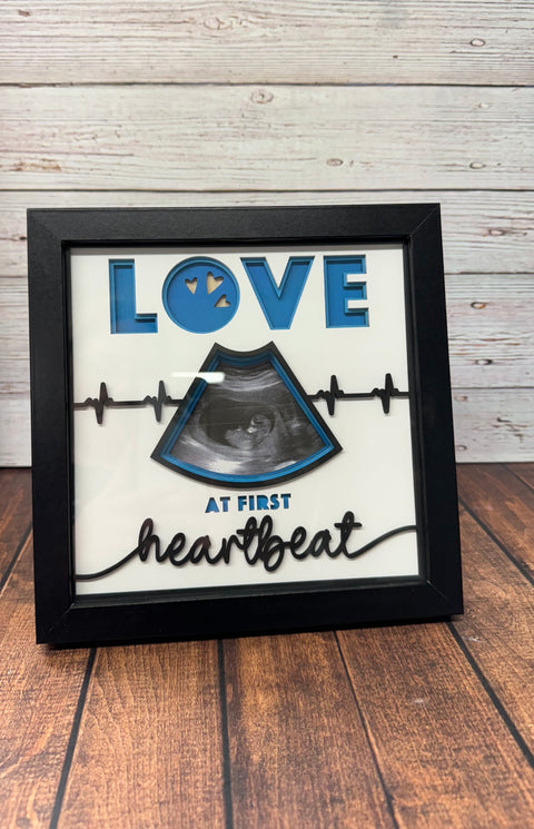 Baby Shadow Box  Love At First Heartbeat  